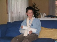 Corentin with two broken arms